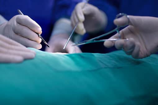 A mother-of-four from Northern Ireland has become the latest person to die after undergoing a gastric sleeve operation in Turkey in order to lose weight.