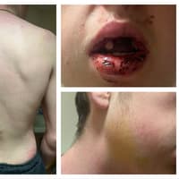 Teens sentenced over horrific Doncaster attack which left victim with serious injuries