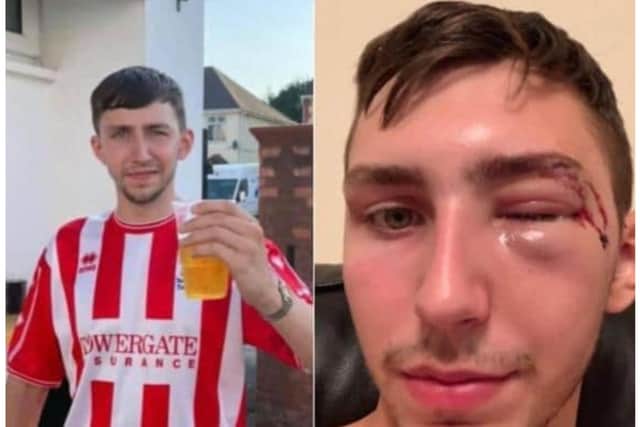 Brad suffered horrific injuries in a baseball bat attack in 2019.
