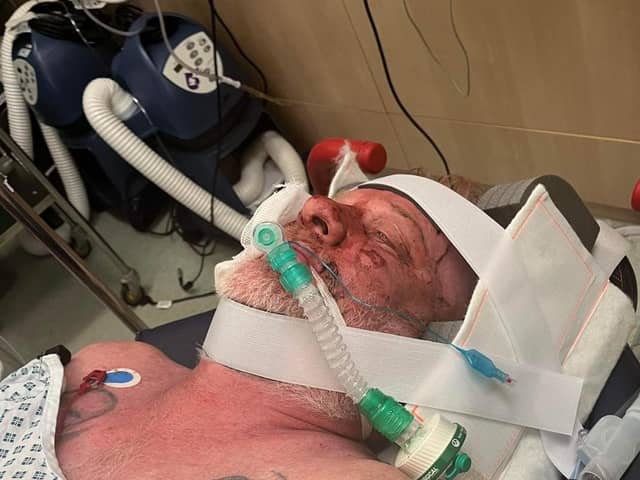 Neil Anderson is in a coma after plunging down an escalator at Doncaster Interchange.
