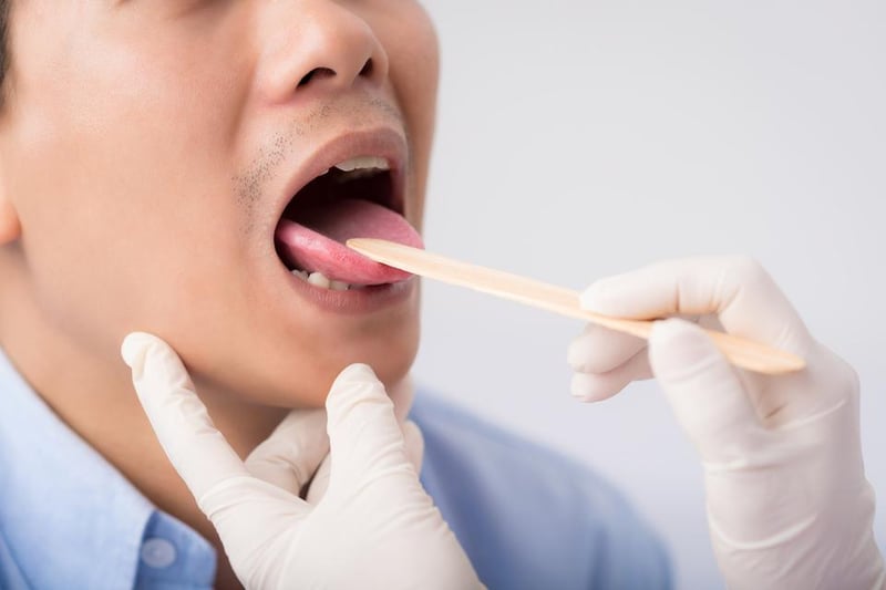 Changes to the tongue or mouth could be a sign of coronavirus, with many people reporting having a dry mouth, changes in tongue sensation, muscle pain while chewing, swelling and ulcers.