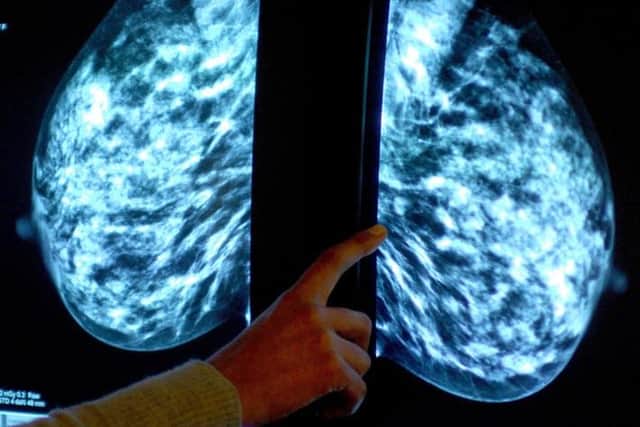Thousands of women have missed screenings.