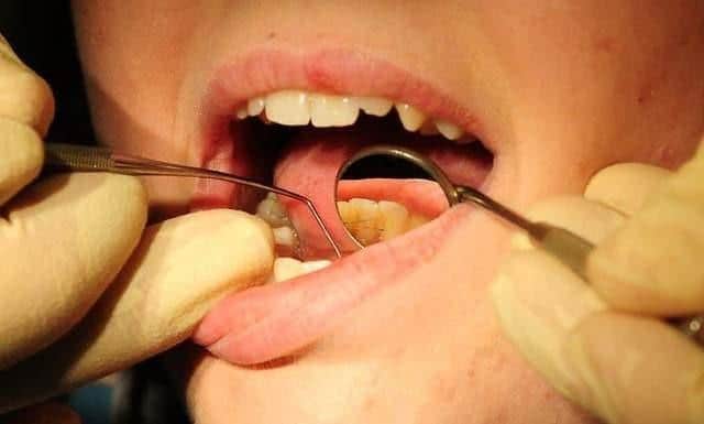 165 Doncaster children had teeth pulled out in hospital last year.
