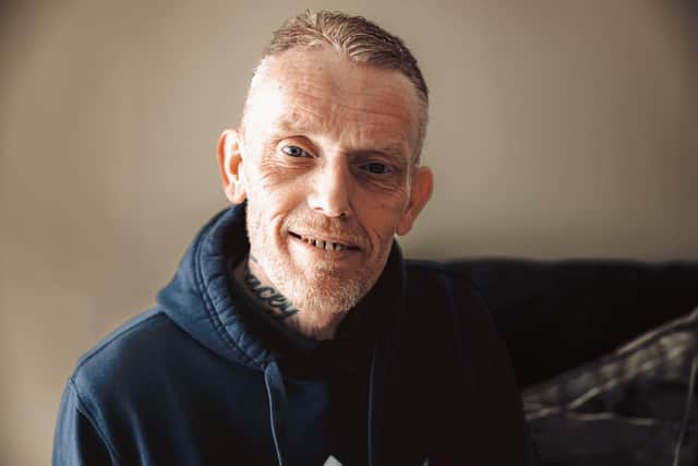 Mike Robinson, of Doncaster, who is recovering from an eating disorder