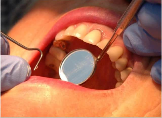 Dentistry in Yorkshire to get more cash to deal with Covid backlog of appointments.