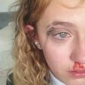 Jessica Gieglis, 12, was left battered and bloodied after the assault in Askern.