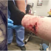 Keeley Leigh suffered serious injuries after being savaged by a dog in Doncaster.