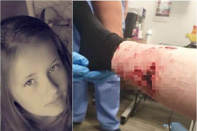 Keeley Leigh suffered serious injuries after being savaged by a dog in Doncaster.