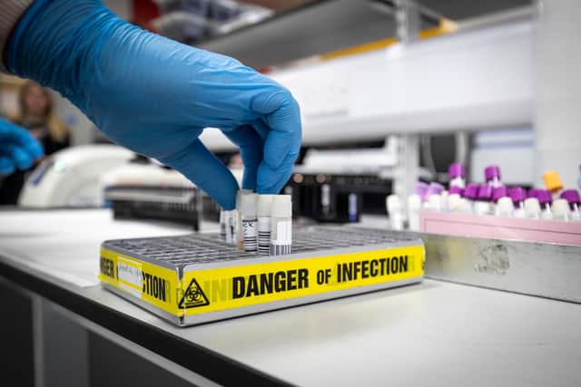 The Office for National Statistics suggests around seven per cent of coronavirus deaths in England and Wales may be taking place outside of hospitals, meaning they are not including in the daily death tolls (Photo by Jane Barlow - WPA Pool/Getty Images)