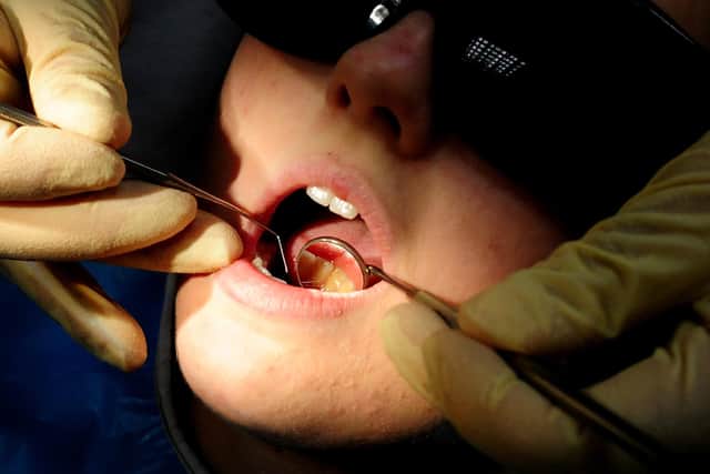 Around 714 in every 100,000 children underwent a tooth extraction for decay last year