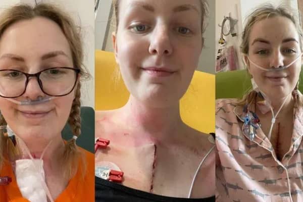 Megan Hetherington is attempting to raise £50,000 for life saving surgery.