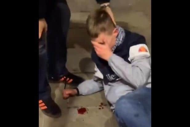 The supporter was left bleeding after a reported attack by Bradford City fans. (Photo/Video: X/Facebook).