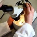 Fewer people in Doncaster completing cervical screenings.