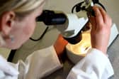 Fewer people in Doncaster completing cervical screenings.