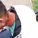 The victim was left bleeding following the incident near to Elmfield Park.