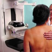 All women aged from 50 up to their 71st birthday are invited for free NHS breast screening.
