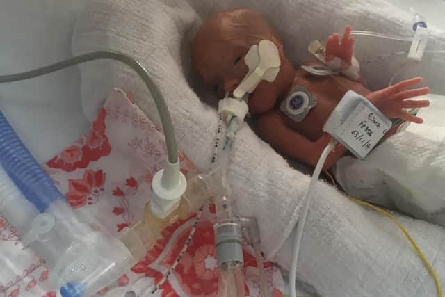Tiny Esmé passed away at the age of just two weeks at Jessops Hospital Sheffield.
