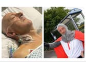 Doncaster TikTok star Donny Knight has launched a funding campaign for a mobility scooter after narrowly avoiding having his foot amputated.