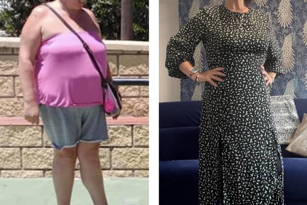 Dawn pictured before and after her weight loss.