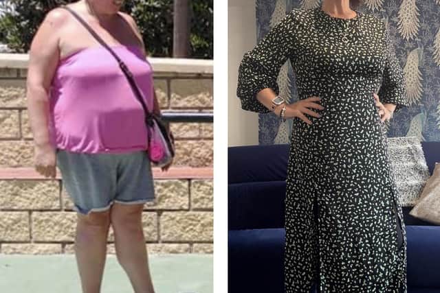 Dawn pictured before and after her weight loss.