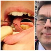 Doncaster Conservative MP Nick Fletcher accused a constituent worried about the lack of dental care in Doncaster of 'trolling' when she contacted him via Facebook.