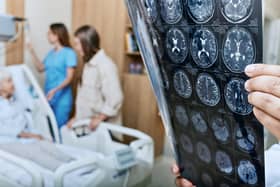 Stroke care