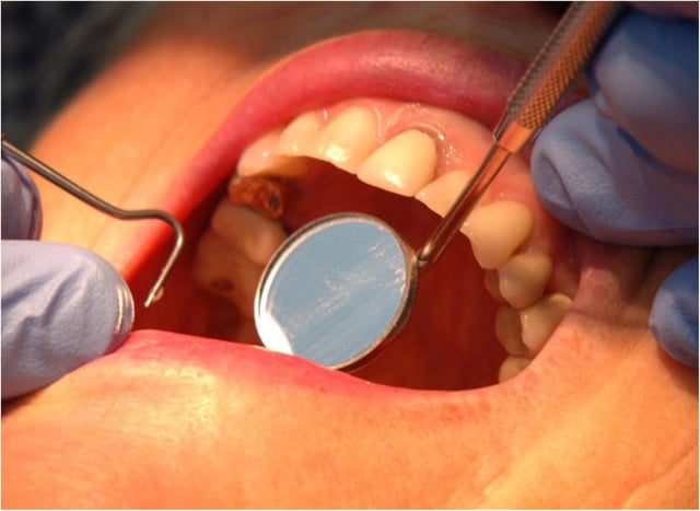 Dentists are struggling because of the coronavirus lockdown.