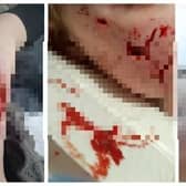 Three children in South Yorkshire have suffered serious injuries after dog attacks.