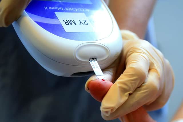 Diabetes UK said the declining proportion of patients receiving necessary checks is hugely concerning