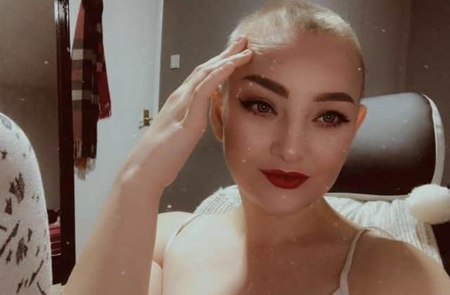 Holly decided to shave her head during her chemotherapy treatment.