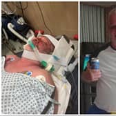 Neil Anderson is still in a coma after plunging headfirst down an escalator at Doncaster interchange.