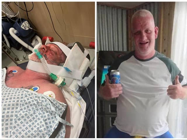 Neil Anderson is still in a coma after plunging headfirst down an escalator at Doncaster interchange.