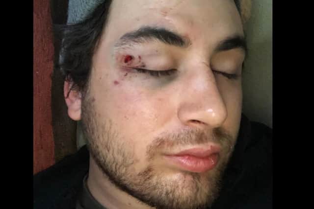 Alexander Lourenco with injuries sustained in the first assault