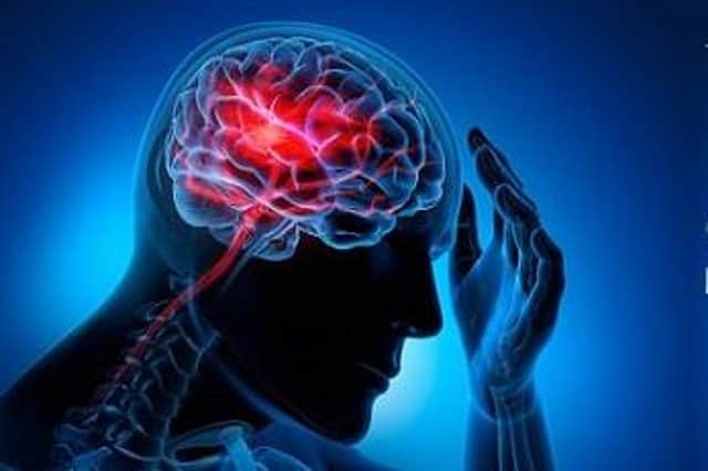 Changes in lifestyle can prevent a stroke