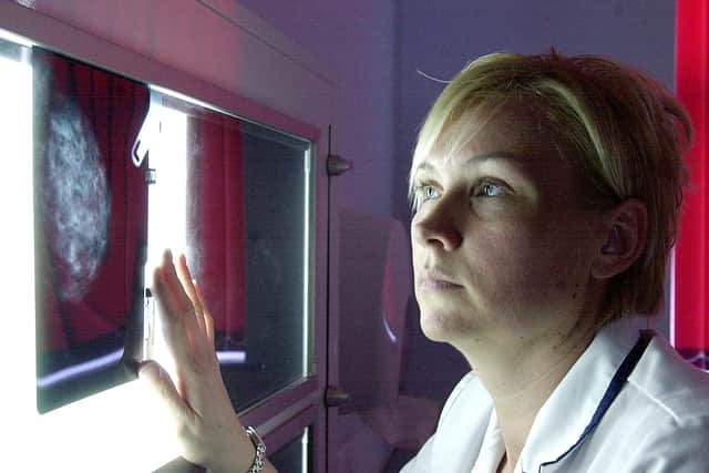 Fire picture shows a radiographer checking a breast cancer scanner image