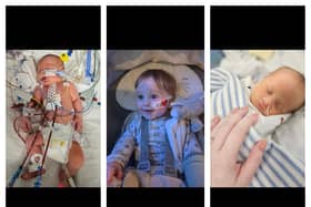 Jackson, now ten months old, has endured a number of medical battles since his birth.