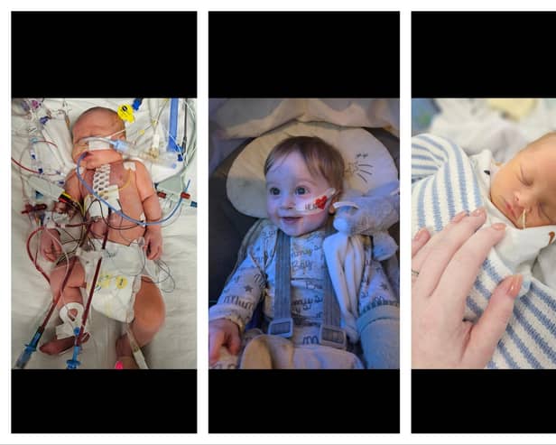 Jackson, now ten months old, has endured a number of medical battles since his birth.