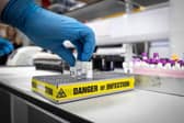 There have now been 1,095 confirmed cases of coronavirus in Sheffield