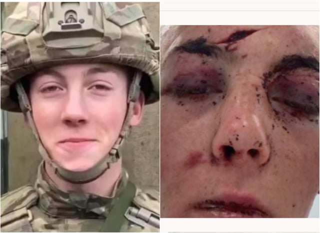 Cobhan Mclelland was left with serious injuries after an alleged attack in Edinburgh. (Photo: GoFundMe).