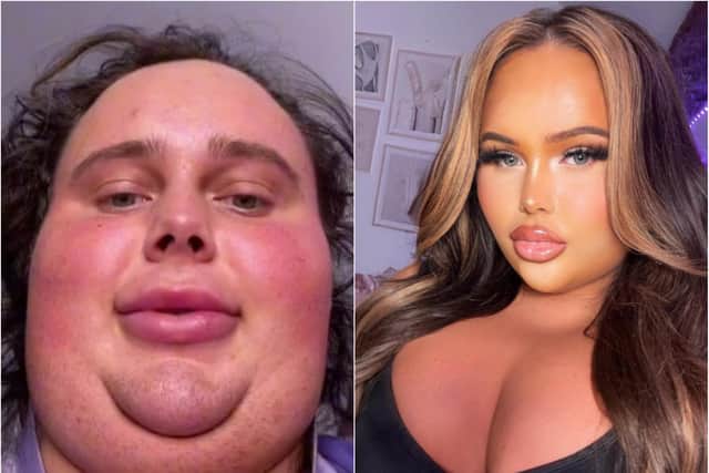Doncaster TikTok 'girl with beard' influencer told catfish transformations  'should be illegal