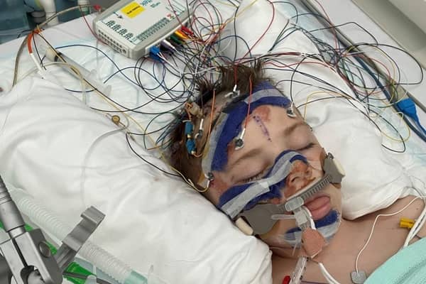Rio Cooper undergoing treatment at Sheffield Children's Hospital.