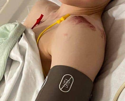 Louie Davies, 13 of High Melton in hospital following his accident.