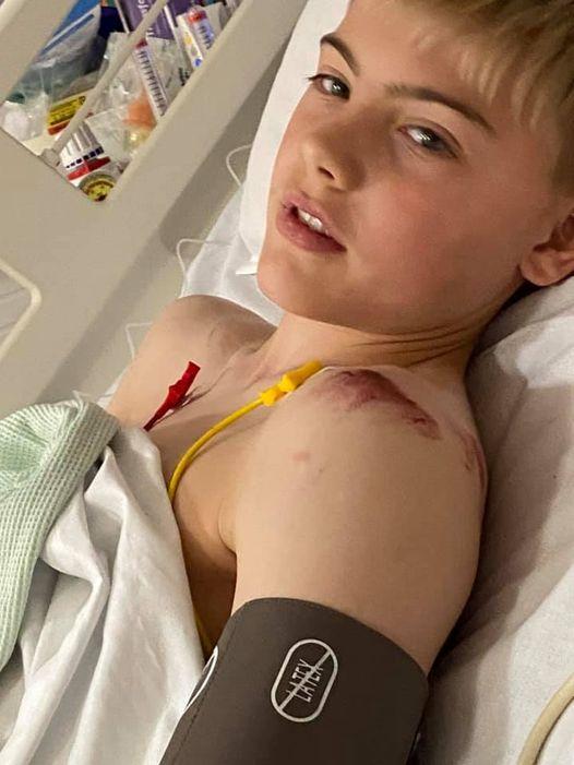 Louie Davies, 13 of High Melton in hospital following his accident.