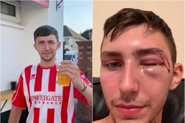 Brad Scarrott suffered horrific injuries after being attacked with a baseball bat.