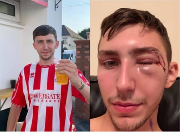 Brad Scarrott suffered horrific injuries after being attacked with a baseball bat.