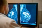 Around 9 in 10 of breast cancers diagnosed through screening are found at an early stage.