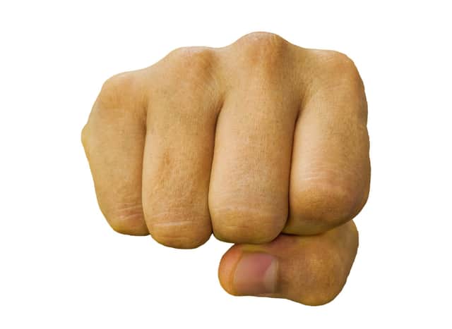 A man has reportedly been asking people to punch him in Mexborough.