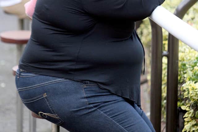 Women accounted for more than two-thirds of obesity-related hospital cases in Doncaster