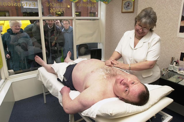 Beverley Guy gave Steve Littlewood a body wax to raise money for Children in Need in 2000
