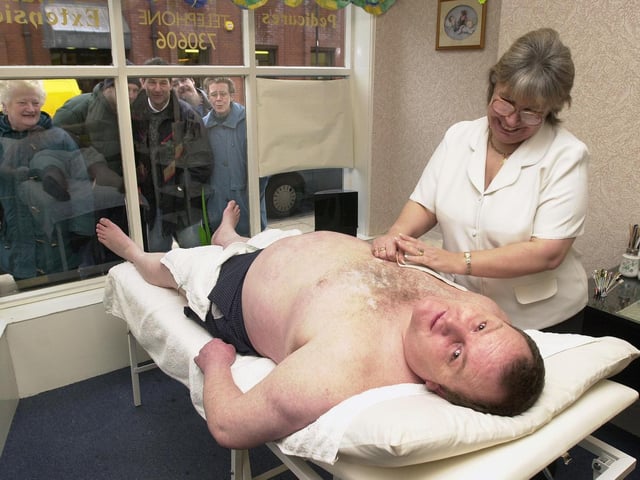 Beverley Guy gave Steve Littlewood a body wax to raise money for Children in Need in 2000